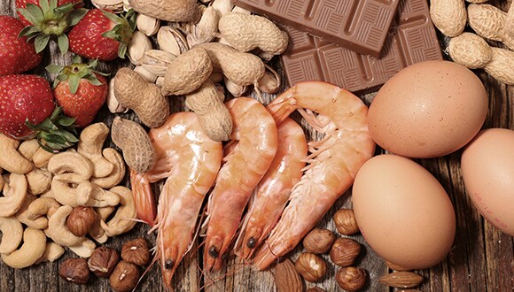 As assortment of food ranging from fruits, nuts, seafood, eggs and chocolate
