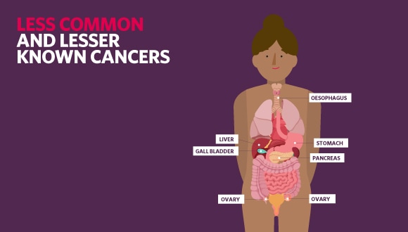 illustration of lesser known and less common cancers