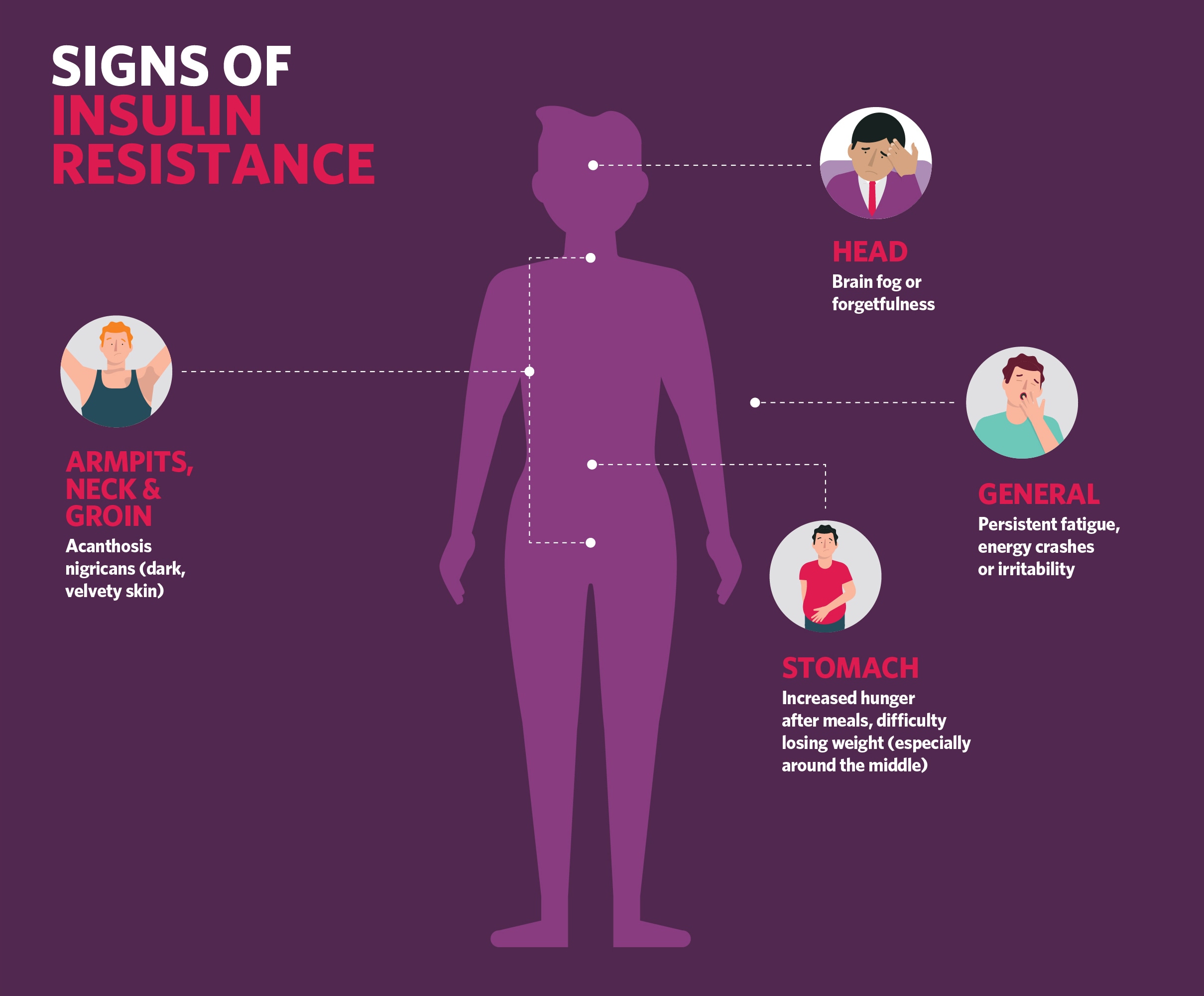 Signs of Insulin Resistance Infographic