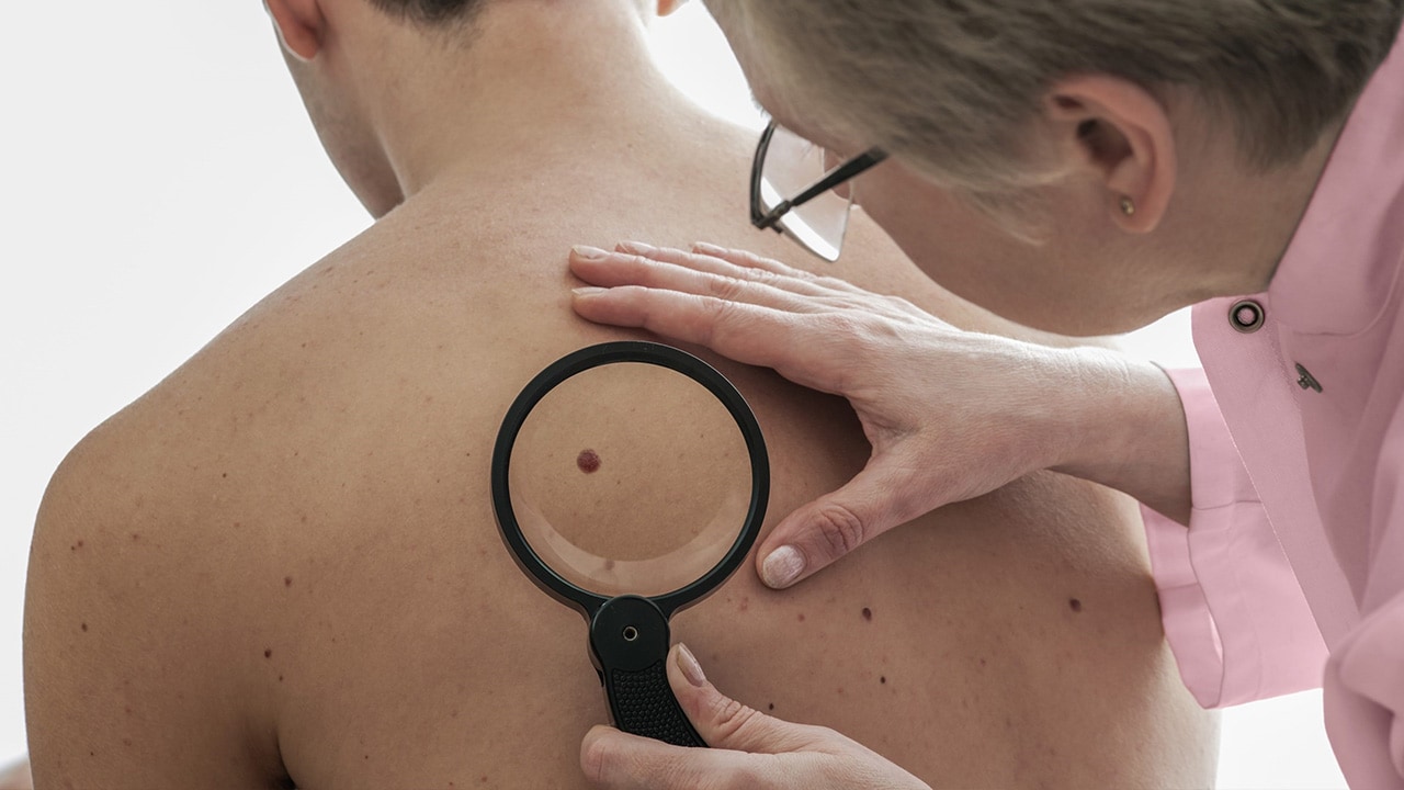  A man getting his skin checked by a doctor.